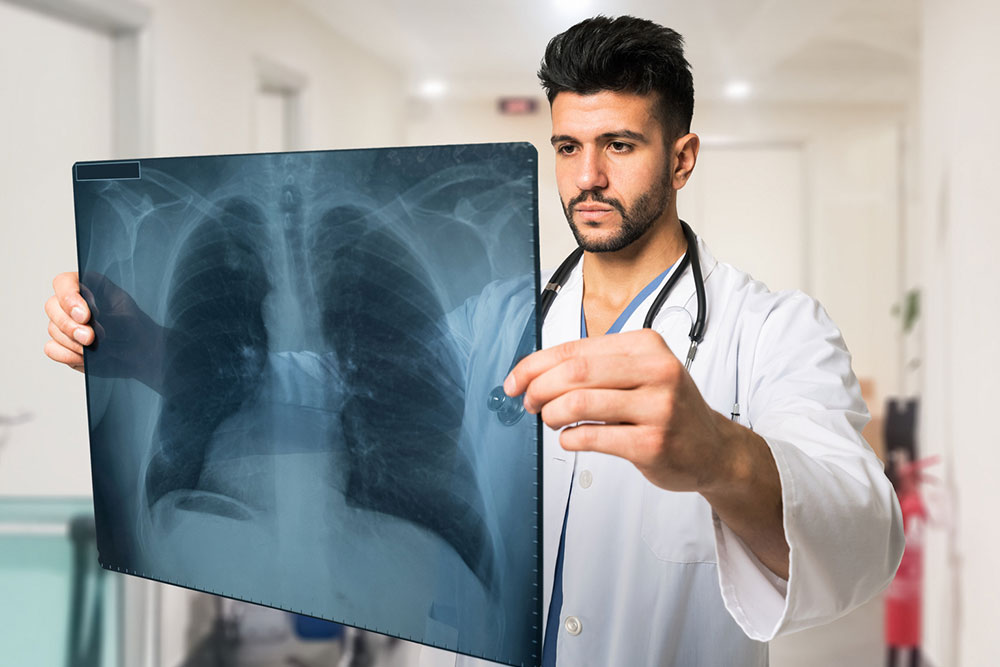 Stage 1 lung cancer – Signs, survival rate, and management
